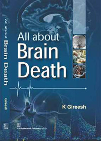 Image of All about Brain Death