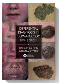 Image of Differential Diagnosis in Dermatology
