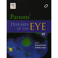 Image of Parsons Disease Of The Eye